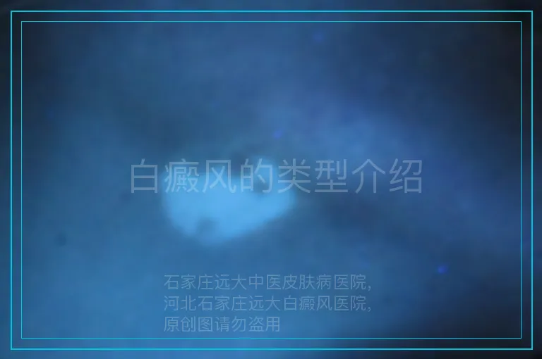 白癜风的类型介绍