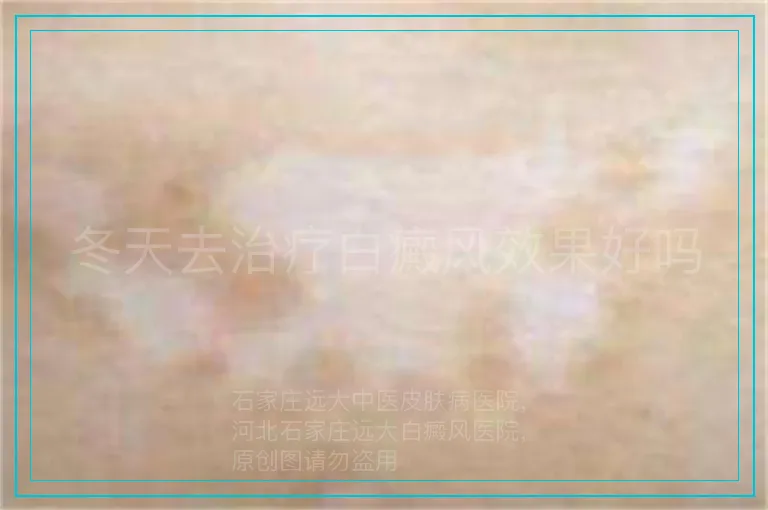 冬天去治疗白癜风效果好吗