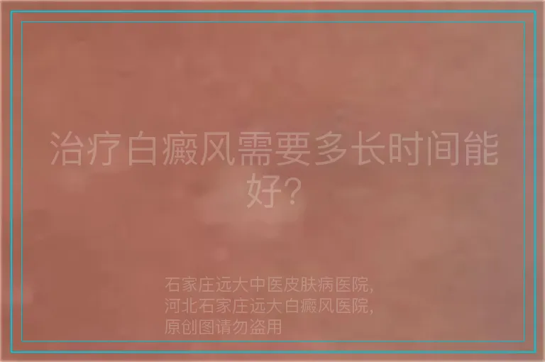 治疗白癜风需要多长时间能好?