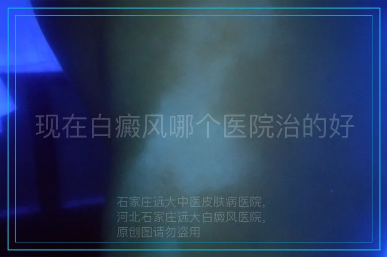 现在白癜风哪个医院治的好