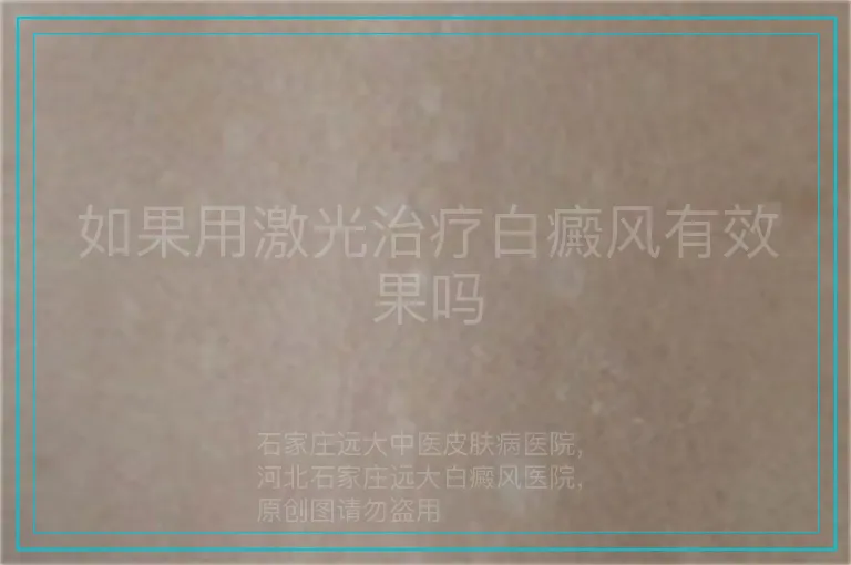 如果用激光治疗白癜风有效果吗
