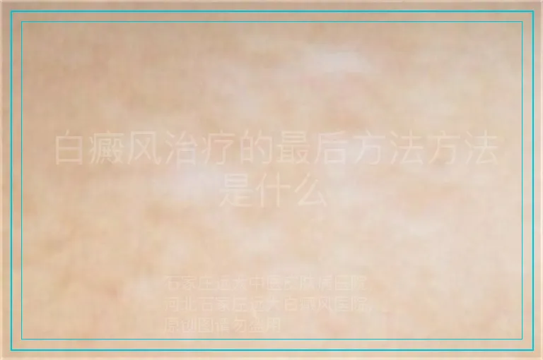 白癜风治疗的最后方法方法是什么