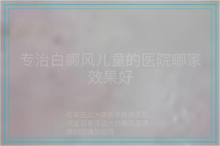 专治白癜风儿童的医院哪家效果好