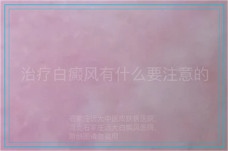治疗白癜风有什么要注意的