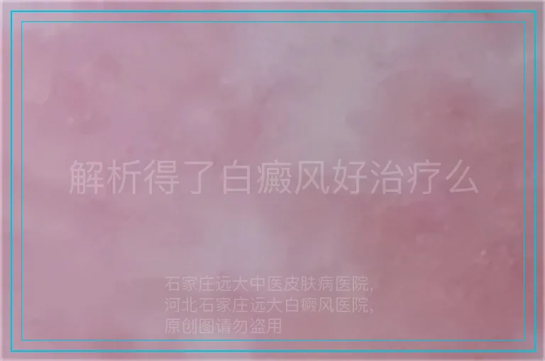 解析得了白癜风好治疗么