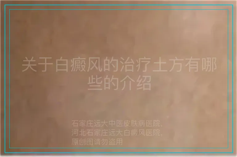 关于白癜风的治疗土方有哪些的介绍