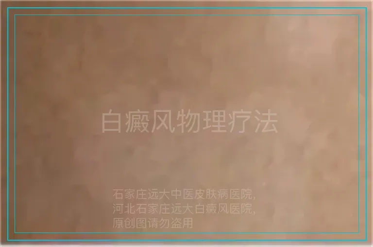 白癜风物理疗法