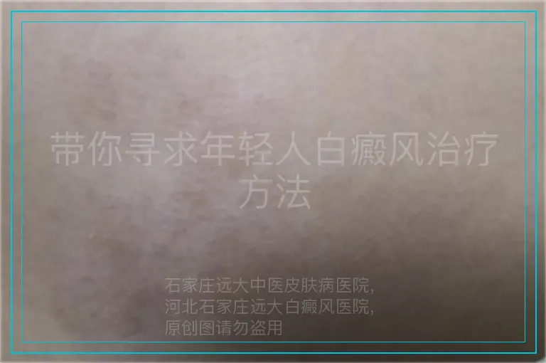 带你寻求年轻人白癜风治疗方法