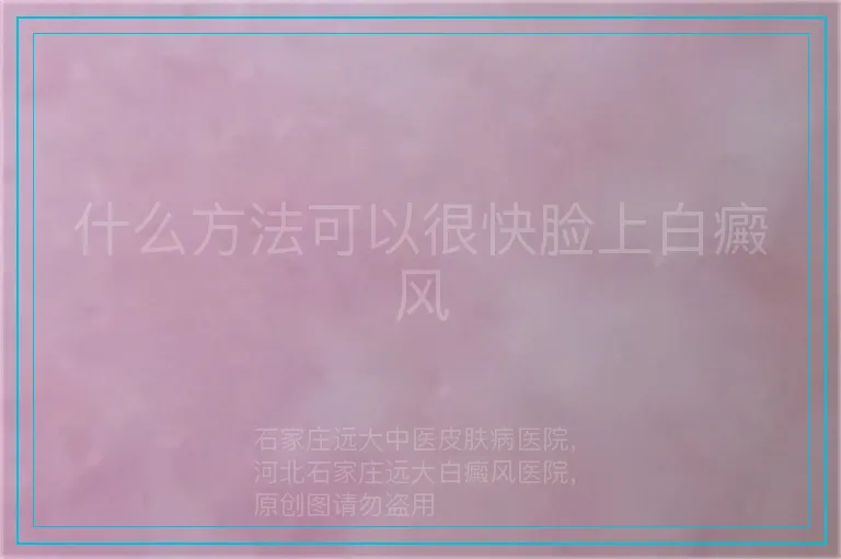 什么方法可以很快脸上白癜风