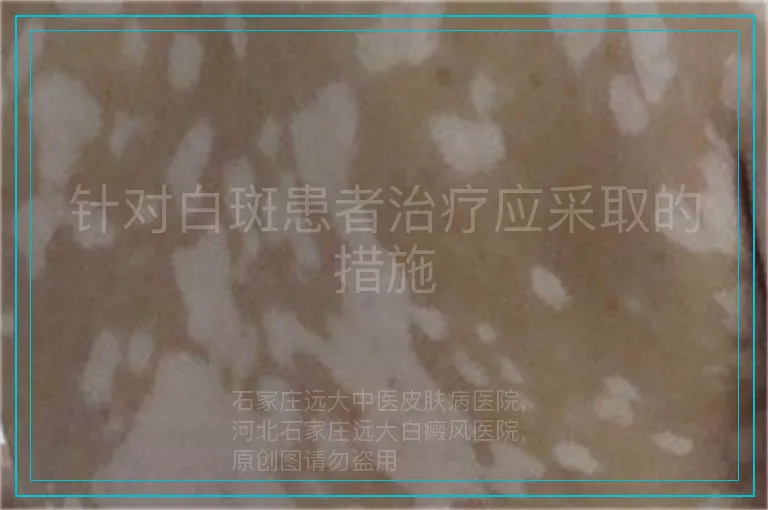 针对白斑患者治疗应采取的措施