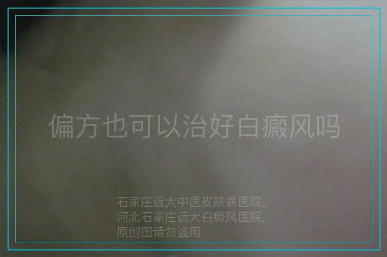 偏方也可以治好白癜风吗
