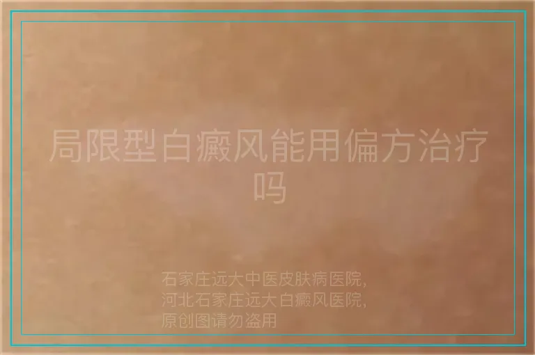 局限型白癜风能用偏方治疗吗