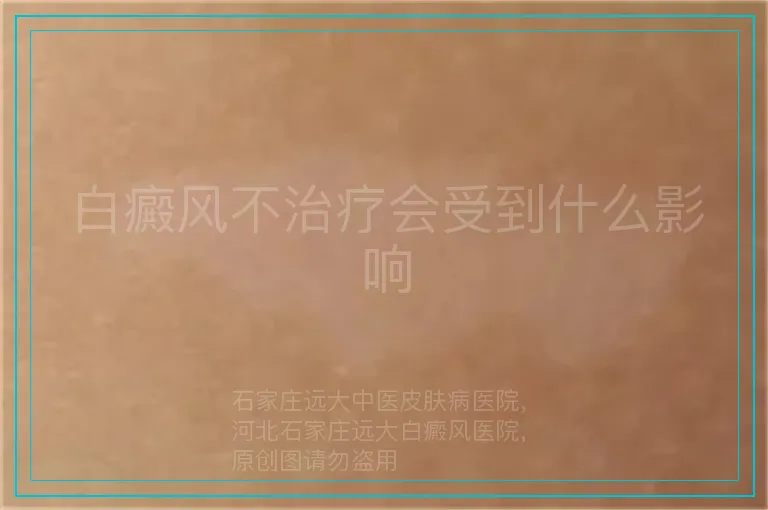 白癜风不治疗会受到什么影响