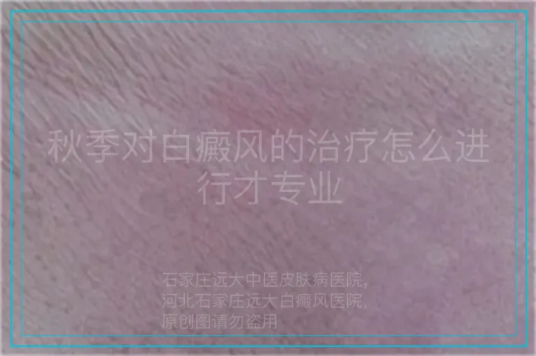 秋季对白癜风的治疗怎么进行才专业