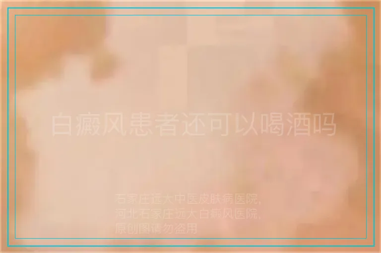 白癜风患者还可以喝酒吗