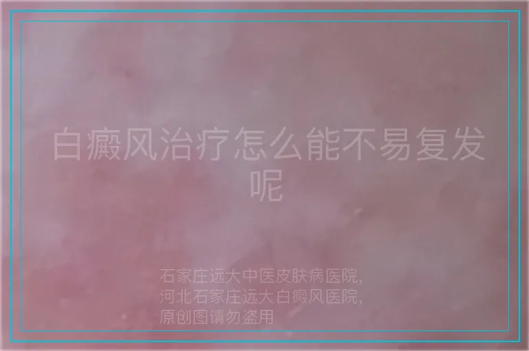白癜风治疗怎么能不易复发呢