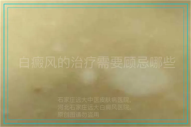 白癜风的治疗需要顾忌哪些