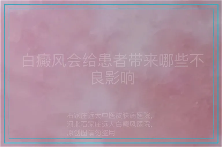 白癜风会给患者带来哪些不良影响