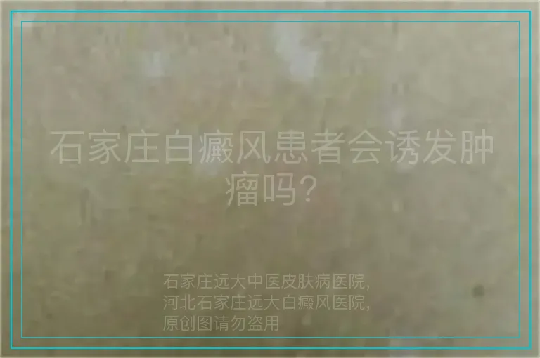 石家庄白癜风患者会诱发肿瘤吗?