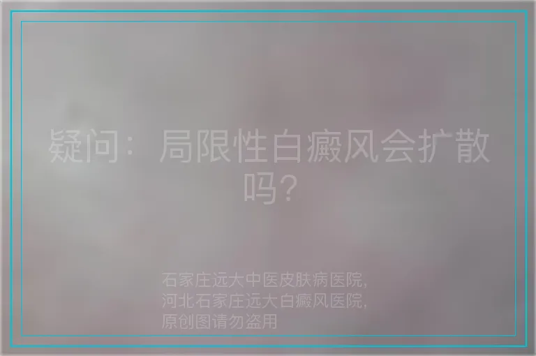 疑问：局限性白癜风会扩散吗?
