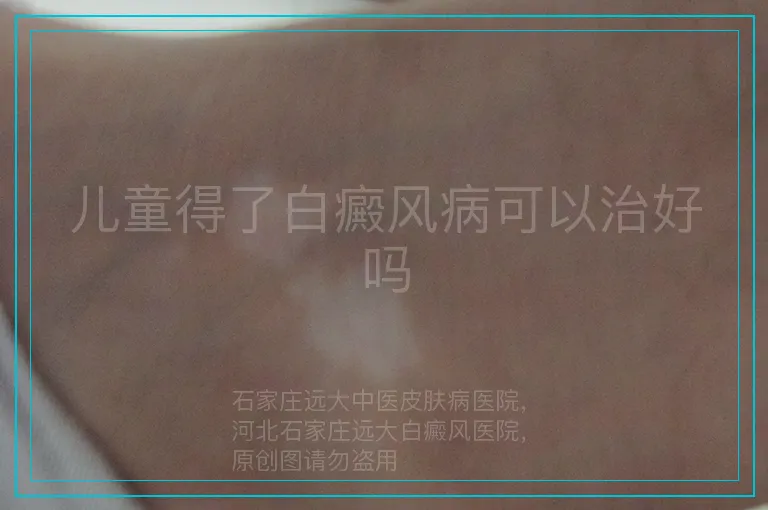 儿童得了白癜风病可以治好吗