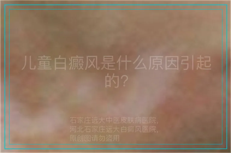 儿童白癜风是什么原因引起的?
