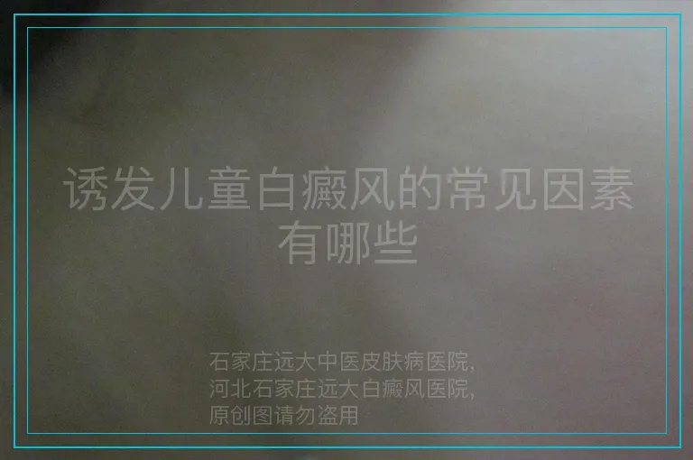 诱发儿童白癜风的常见因素有哪些