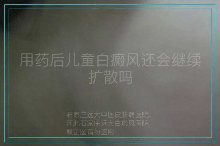 用药后儿童白癜风还会继续扩散吗