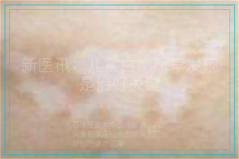 新医讯：儿童白癜风早发现是治好关键