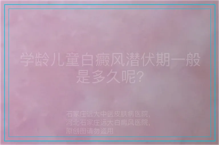学龄儿童白癜风潜伏期一般是多久呢?