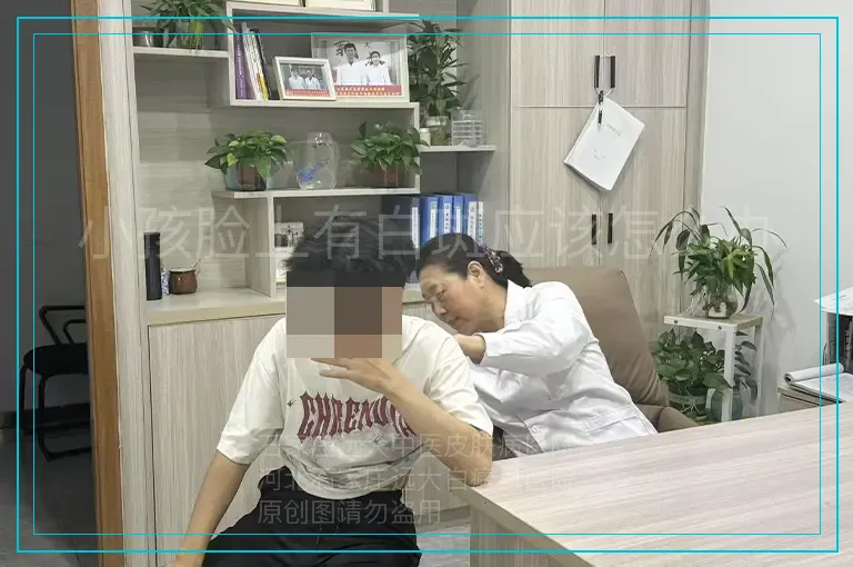 小孩脸上有白斑应该怎么办?