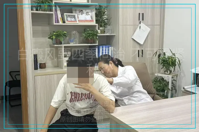 白癜风要四季同治 不可夏紧秋松