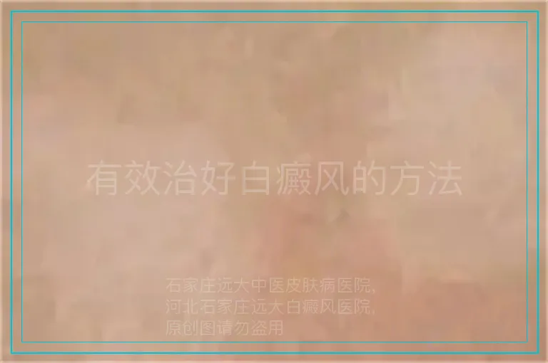 有效治好白癜风的方法