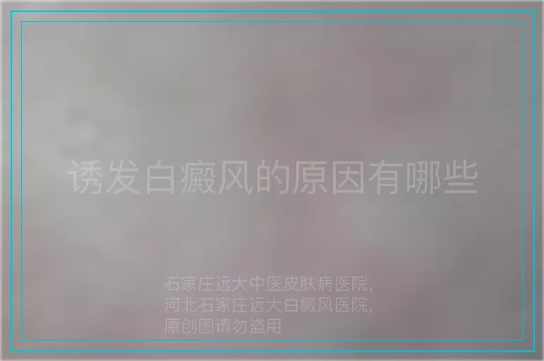 诱发白癜风的原因有哪些