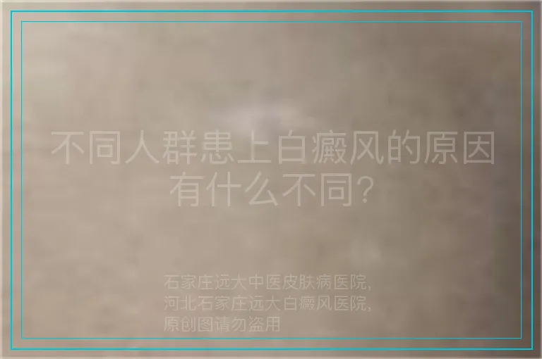 不同人群患上白癜风的原因有什么不同?