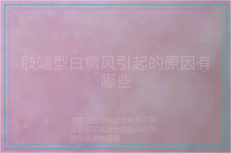 肢端型白癜风引起的原因有哪些