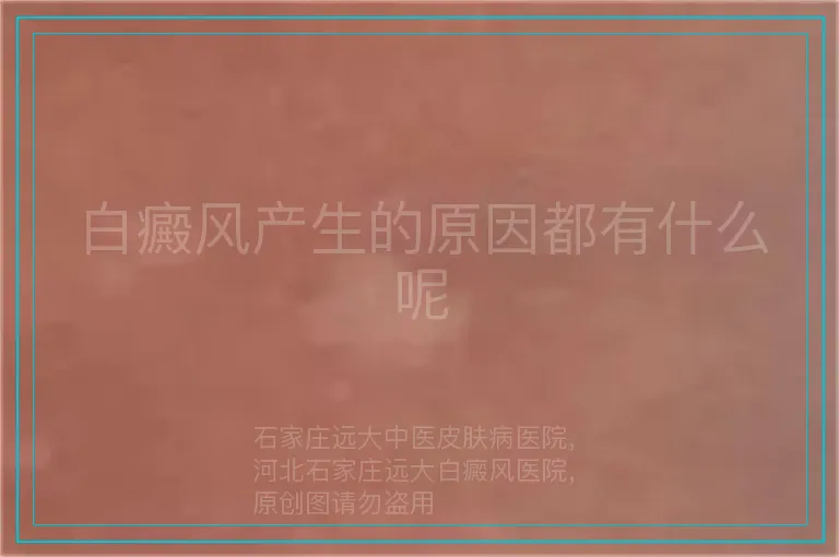 白癜风产生的原因都有什么呢
