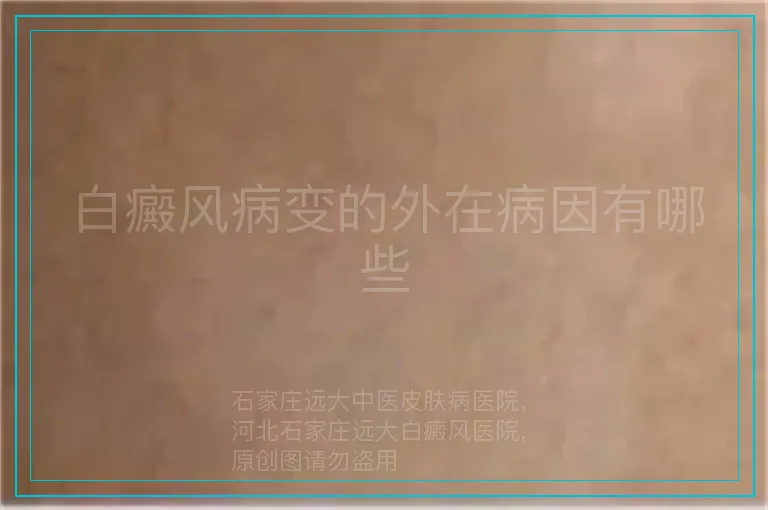 白癜风病变的外在病因有哪些