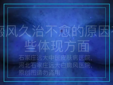 白癜风久治不愈的原因有哪些体现方面