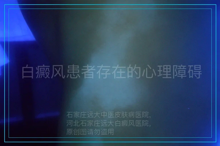 白癜风患者存在的心理障碍