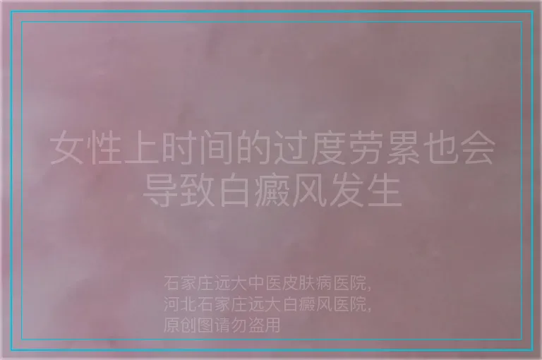 女性上时间的过度劳累也会导致白癜风发生