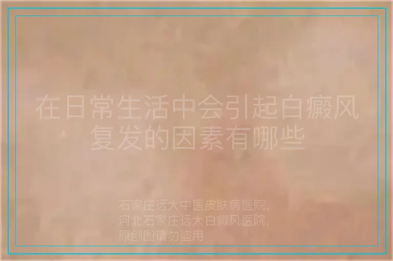 在日常生活中会引起白癜风复发的因素有哪些