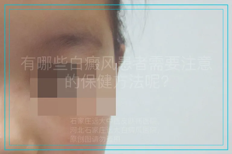 有哪些白癜风患者需要注意的保健方法呢?