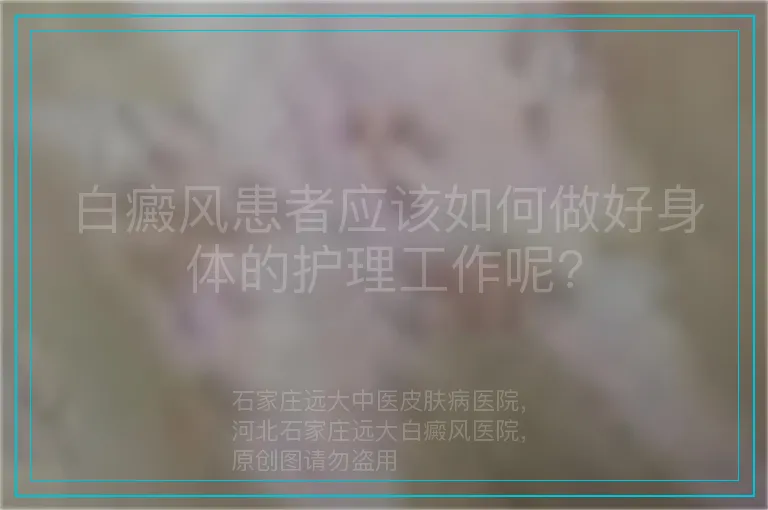 白癜风患者应该如何做好身体的护理工作呢?