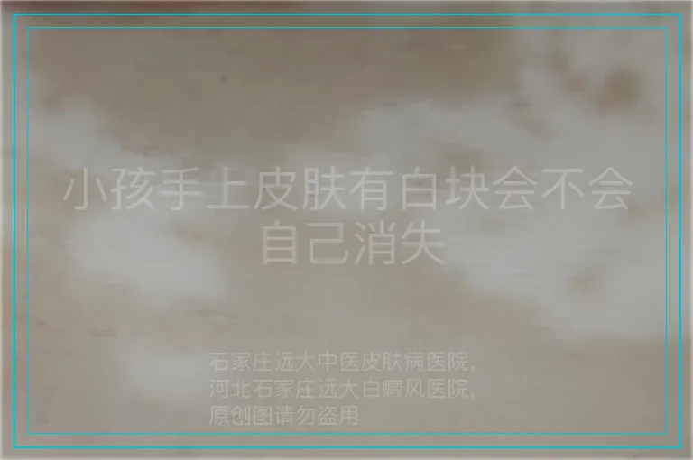 小孩手上皮肤有白块会不会自己消失