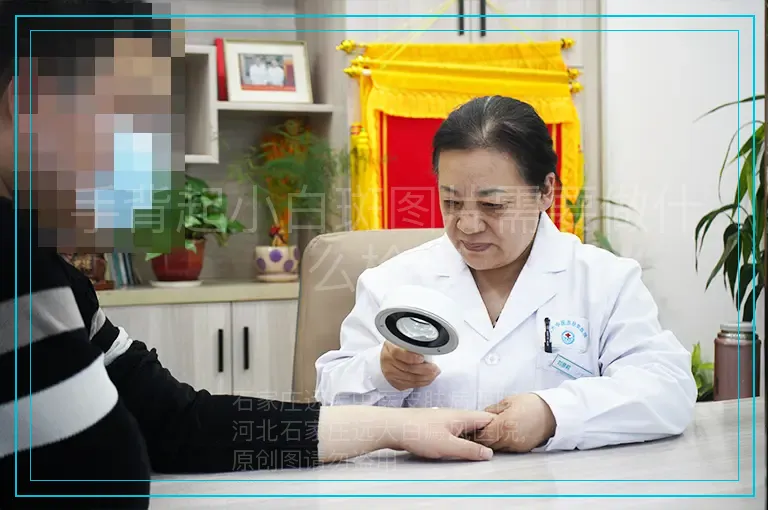 手背起小白斑图片需要做什么检查