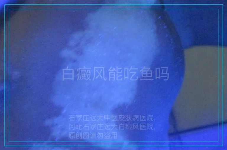 白癜风能吃鱼吗