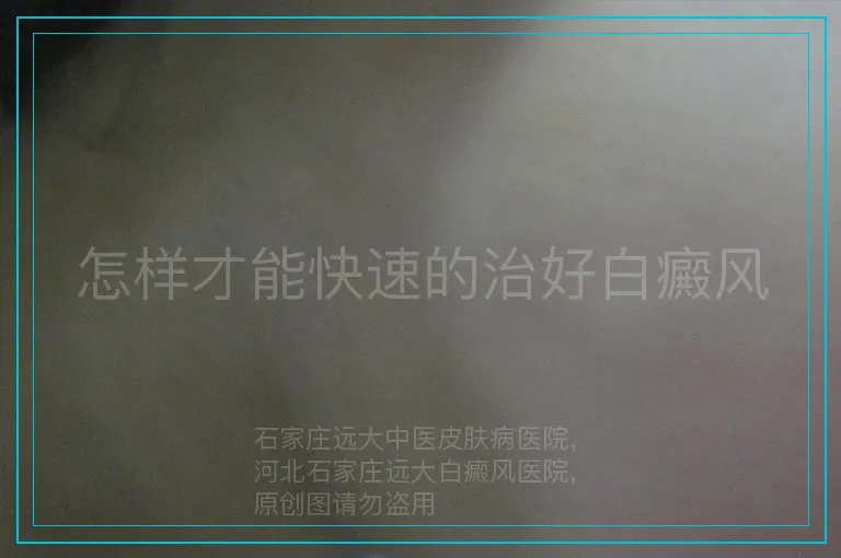 怎样才能快速的治好白癜风
