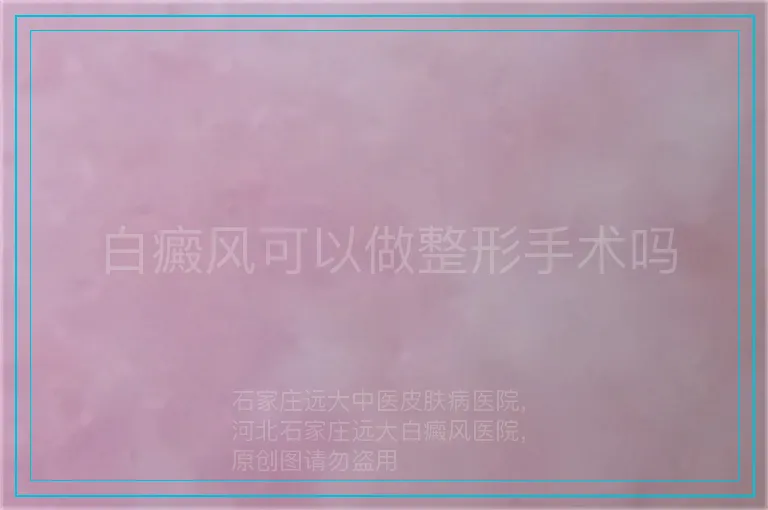 白癜风可以做整形手术吗