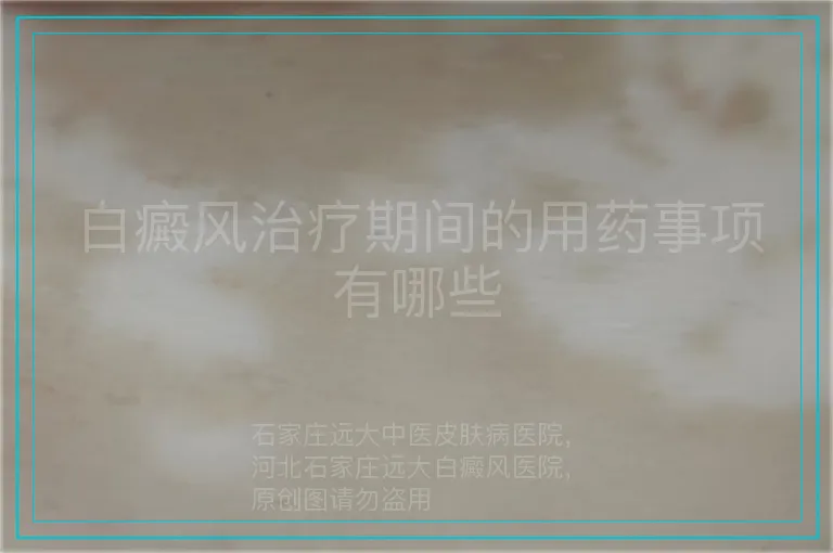 白癜风治疗期间的用药事项有哪些